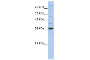 GAPDH antibody used at 1 ug/ml to detect target protein. (GAPDH 抗体  (Middle Region))