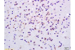 Formalin-fixed and paraffin embedded rat brain labeled with Anti-ADCY7 Polyclonal Antibody, Unconjugated (ABIN751213) at 1:200 followed by conjugation to the secondary antibody and DAB staining. (ADCY7 抗体  (AA 901-1080))