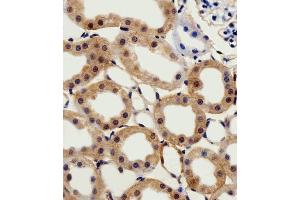 Immunohistochemical analysis of paraffin-embedded R. (CSNK2A1/CK II alpha 抗体  (AA 250-284))