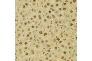 Immunohistochemistry of paraffin-embedded rat liver using HDGF Antibody. (HDGF 抗体  (AA 1-240))