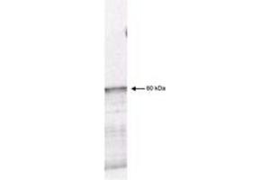Image no. 1 for anti-3-phosphoinositide Dependent Protein Kinase-1 (PDPK1) (AA 301-312) antibody (ABIN199938) (PDPK1 抗体  (AA 301-312))