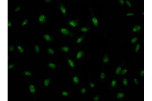 Immunofluorescence staining of Hela Cells with ABIN7127571 at 1:50, counter-stained with DAPI. (Recombinant Interleukin enhancer-binding factor 3 (ILF3) 抗体)