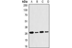 Western blot analysis of PSMB4 expression in MCF7 (A), SKOV3 (B), mouse thymus (C), mouse liver (D) whole cell lysates.