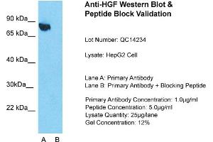 Host: Rabbit  Target Name: HGF  Sample Tissue: Human HepG2 cell  Lane A:  Primary Antibody Lane B:  Primary Antibody + Blocking Peptide Primary Antibody Concentration: 1 µg/mL Peptide Concentration: 5. (HGF 抗体  (N-Term))