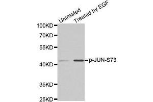 Western blot analysis of extracts from PC14 cells using phospho-JUN-S73 antibody.