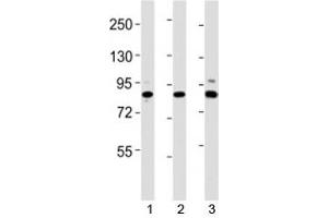 Western blot testing of Suz12 antibody at 1:2000 dilution. (SUZ12 抗体  (AA 381-395))