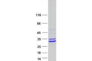 Validation with Western Blot