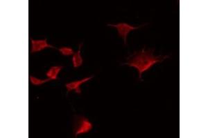 ABIN6275124 staining NIH-3T3 by IF/ICC. (Fibulin 5 抗体  (C-Term))
