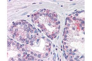 Anti-PDE11A antibody IHC of human prostate. (PDE11A 抗体  (AA 455-468))
