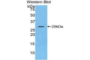 Western Blotting (WB) image for anti-Fibroblast Growth Factor Receptor 2 (FGFR2) (AA 157-377) antibody (ABIN3206051) (FGFR2 抗体  (AA 157-377))