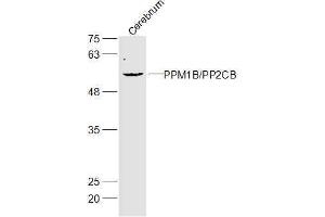 Mouse cerebrum lysates probed with Gliomedin Polyclonal Antibody, Unconjugated  at 1:300 dilution and 4˚C overnight incubation. (GLDN 抗体  (AA 365-460))