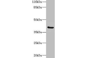 Western blot All lanes: CA12 antibody at 2 μg/mL + Mouse kidney tissue Secondary Goat polyclonal to rabbit IgG at 1/10000 dilution Predicted band size: 40, 39 kDa Observed band size: 40 kDa (CA12 抗体  (AA 25-301))