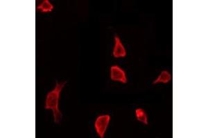 ABIN6267646 staining HeLa by IF/ICC. (Cortactin 抗体  (pTyr466))