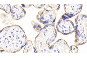 Immunohistochemistry (IHC) image for anti-5'-Nucleotidase, Ecto (CD73) (NT5E) (AA 29-500) antibody (ABIN7433327)