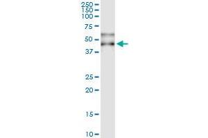 Immunoprecipitation of SERPINA3 transfected lysate using anti-SERPINA3 MaxPab rabbit polyclonal antibody and Protein A Magnetic Bead , and immunoblotted with SERPINA3 purified MaxPab mouse polyclonal antibody (B01P) . (SERPINA3 抗体  (AA 1-423))