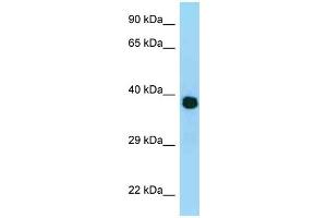 WB Suggested Anti-MRPL3 Antibody Titration: 1. (MRPL3 抗体  (N-Term))