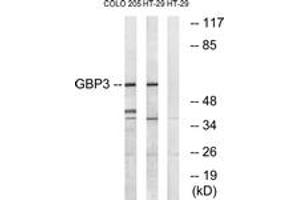 Western blot analysis of extracts from HT-29/COLO cells, using GBP3 Antibody. (GBP3 抗体  (AA 481-530))