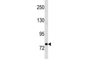 Western Blotting (WB) image for anti-Signal Transducer and Activator of Transcription 3 (Acute-Phase Response Factor) (STAT3) (AA 4-31) antibody (ABIN3032573)