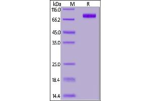 SDS-PAGE (SDS) image for MHC Class I Polypeptide-Related Sequence A (MICA) (AA 24-308) (Active) protein (Fc Tag) (ABIN7013491)