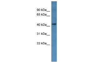 WB Suggested Anti-MAGEA11 Antibody Titration: 0. (MAGEA11 抗体  (Middle Region))