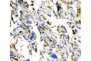 IHC analysis of ACE using anti-ACE antibody (ABIN3043777). (Angiotensin I Converting Enzyme 1 抗体  (AA 651-864))