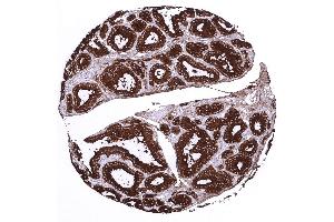 thyroid gland (Recombinant Thyroglobulin 抗体)