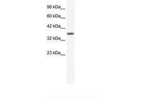 Image no. 1 for anti-Annexin A3 (ANXA3) (C-Term) antibody (ABIN202242) (Annexin A3 抗体  (C-Term))