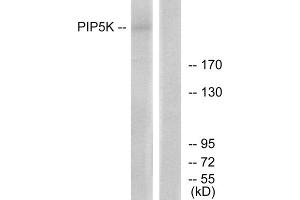 Western blot analysis of extracts from HepG2 cells, using PIP5K antibody. (PIKFYVE 抗体  (N-Term))