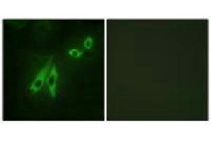 Immunofluorescence analysis of NIH/3T3 cells, using AKAP3 antibody. (AKAP3 抗体)