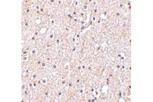 Immunohistochemistry of BRSK2 in human brain tissue with BRSK2 polyclonal antibody  at 5 ug/mL .