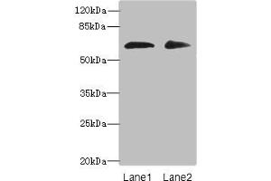 Western blot All lanes: ZNF529 antibody at 6 μg/mL Lane 1: Hela whole cell lysate Lane 2: MCF-7 whole cell lysate Secondary Goat polyclonal to rabbit IgG at 1/10000 dilution Predicted band size: 66 kDa Observed band size: 66 kDa (ZNF529 抗体  (AA 393-563))