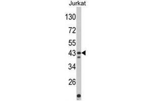 Western blot analysis of CECR5 Antibody (Center) in Jurkat cell line lysates (35ug/lane). (CECR5 抗体  (Middle Region))