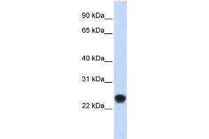 WB Suggested Anti-FKBAntibody Titration:  0. (FKBP11 抗体  (N-Term))