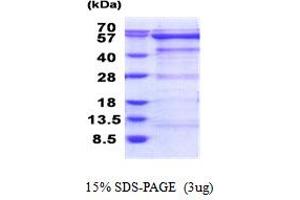 Oxidative-Stress Responsive 1 (OXSR1) (AA 1-527) protein (His tag)