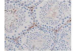 ABIN6267467 at 1/200 staining Mouse testis tissue sections by IHC-P. (CDC25B 抗体  (pSer323))