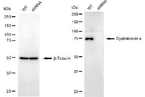 Western blotting analysis using dystrobrevin alpha antibody (ABIN7798410). (DTNA 抗体)
