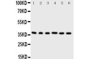 Western Blotting (WB) image for anti-Cyclin-Dependent Kinase 7 (CDK7) (AA 329-346), (C-Term) antibody (ABIN3042892) (CDK7 抗体  (C-Term))