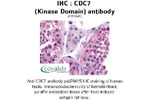 Image no. 1 for anti-Cell Division Cycle 7 (CDC7) antibody (ABIN1732913) (CDC7 抗体)