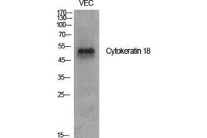 Western Blot (WB) analysis of specific cells using Cytokeratin 18 Polyclonal Antibody. (Cytokeratin 18 抗体  (Ser726, Ser731))