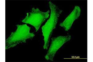 Immunofluorescence (IF) image for anti-Prefoldin Subunit 3 (PFDN3) (AA 1-197) antibody (ABIN521301)