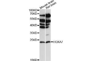 Western blot analysis of extracts of various cell lines, using HOX antibody (ABIN6128063, ABIN6141940, ABIN6141941 and ABIN6216689) at 1:3000 dilution. (HOXA7 抗体  (AA 1-120))