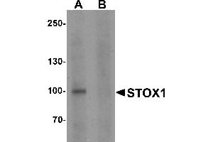 Western blot analysis of STOX1 in human liver tissue lysate with STOX1 antibody at 1 µg/mL in (A) the absence and (B) the presence of blocking peptide. (STOX1 抗体  (C-Term))