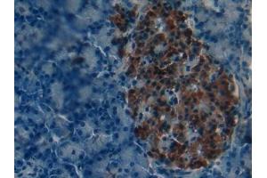 Detection of iPLA2 in Mouse Pancreas Tissue using Polyclonal Antibody to Phospholipase A2, Calcium Independent (iPLA2) (PNPLA2 抗体  (AA 481-702))