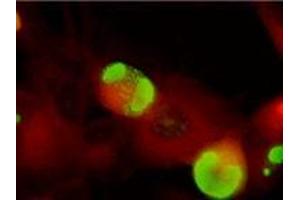 Immunofluorescence (IF) image for anti-ICP36 DNA Binding Protein (CMV ICP36) antibody (ABIN265542) (ICP36 DNA Binding Protein (CMV ICP36) 抗体)