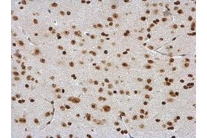 IHC-P Image DDX56 antibody detects DDX56 protein at nucleus in mouse brain by immunohistochemical analysis.