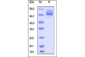 Human IL-7 R alpha, Mouse IgG2a Fc Tag on  under reducing (R) condition. (IL7R Protein (AA 21-236) (Fc Tag))