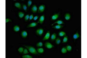 Immunofluorescent analysis of A549 cells using ABIN7166191 at dilution of 1:100 and Alexa Fluor 488-congugated AffiniPure Goat Anti-Rabbit IgG(H+L) (Protein Tob1 (TOB1) (AA 42-175) 抗体)