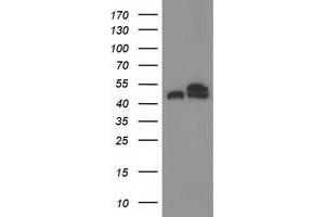 Western Blotting (WB) image for anti-Tubulin beta 4a (TUBB4A) antibody (ABIN1501579) (TUBB4 抗体)
