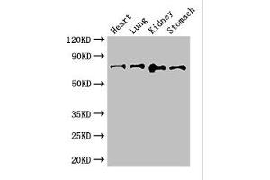 Western Blot Positive WB detected in: Mouse heart tissue, Mouse lung tissue, Mouse kidney tissue, Mouse stomach tissue All lanes: ABCG8 antibody at 2. (ABCG8 抗体  (AA 176-413))