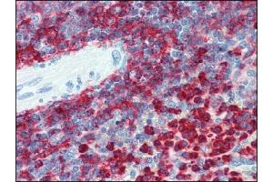 Immunohistochemistry (IHC) image for anti-Integrin beta 2 (ITGB2) antibody (ABIN614281) (Integrin beta 2 抗体)